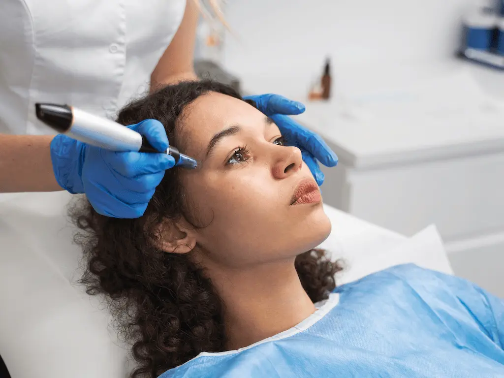 Microneedling Gesichtsbehandlung